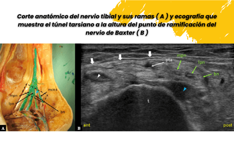 3. Ramas nerviosas tunel tarso.png